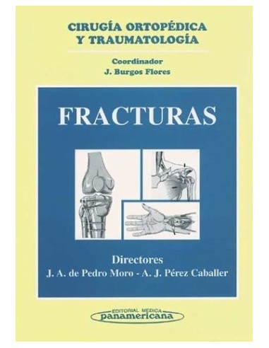 FRACTURAS (CIRUGIA ORTOPEDICA Y...