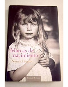 MARCAS DE NACIMIENTO