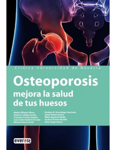 OSTEOPOROSIS. MEJORA LA SALUD DE TUS...
