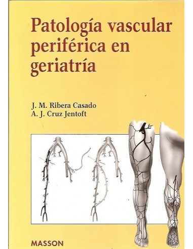 PATOLOGIA VASCULAR PERIFERICA EN...